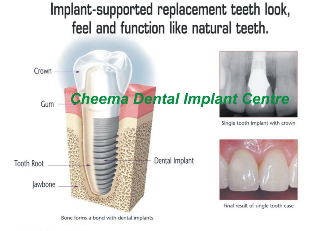 click to enlarge image